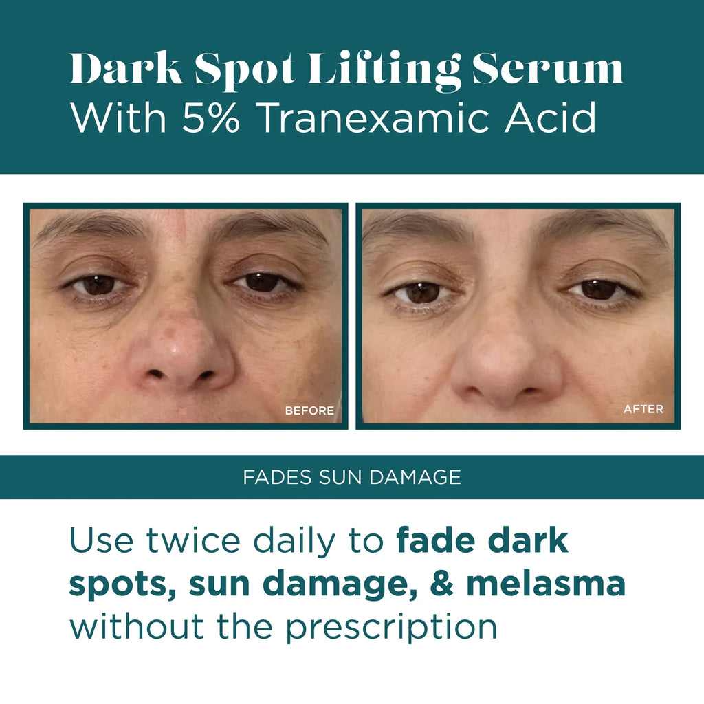 Dark Spot Lifting Serum