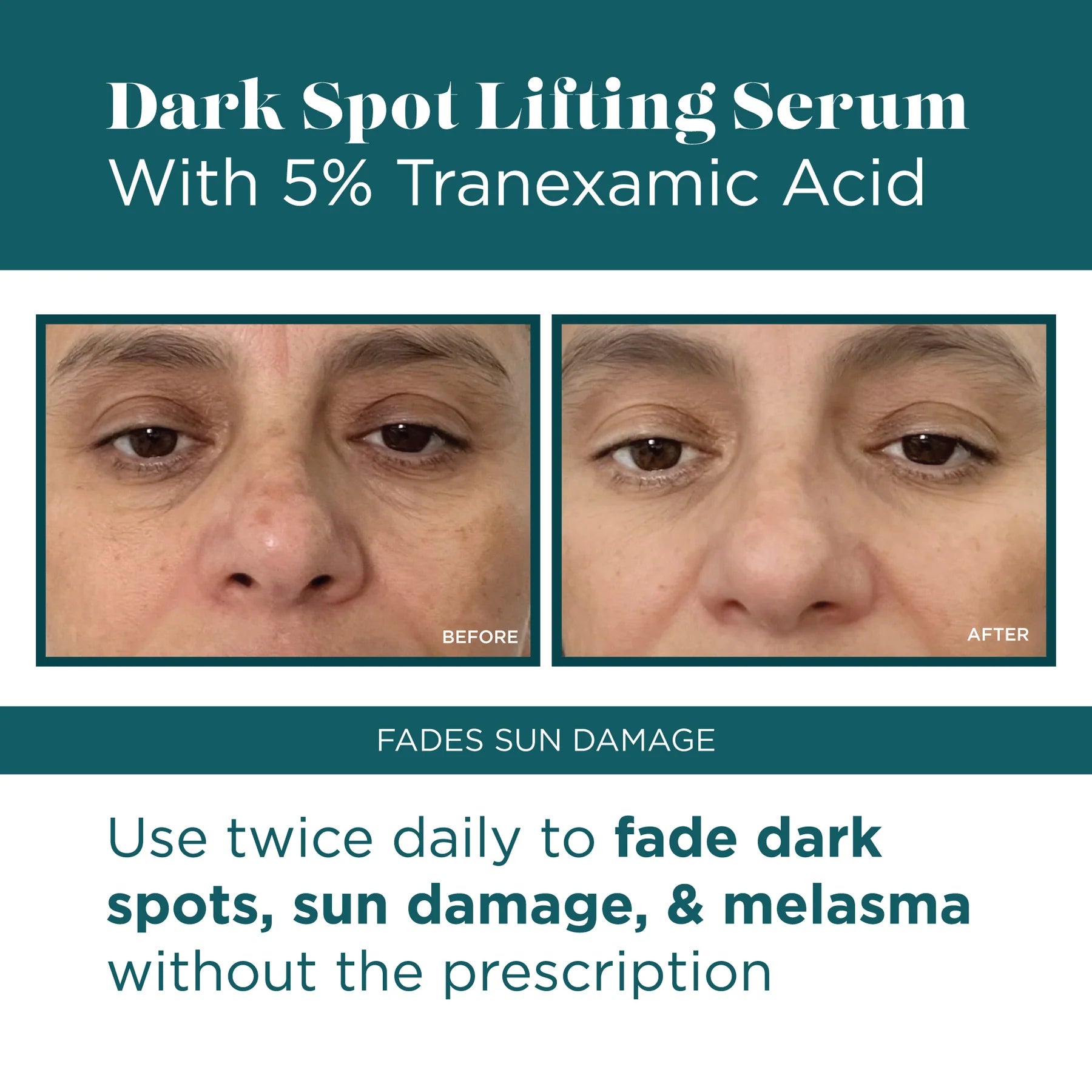 Dark Spot Lifting Serum