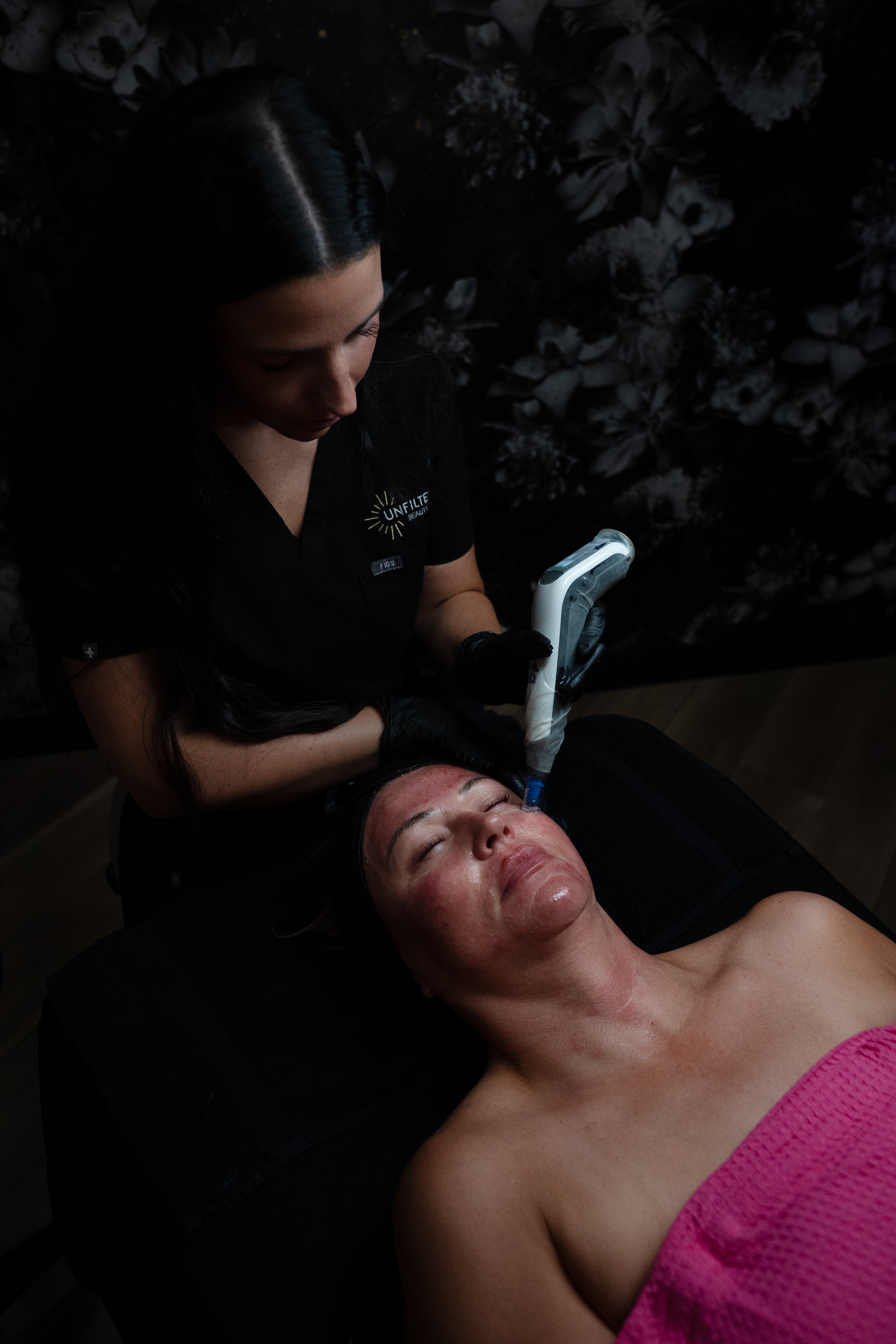 Microneedling with Collagen Booster