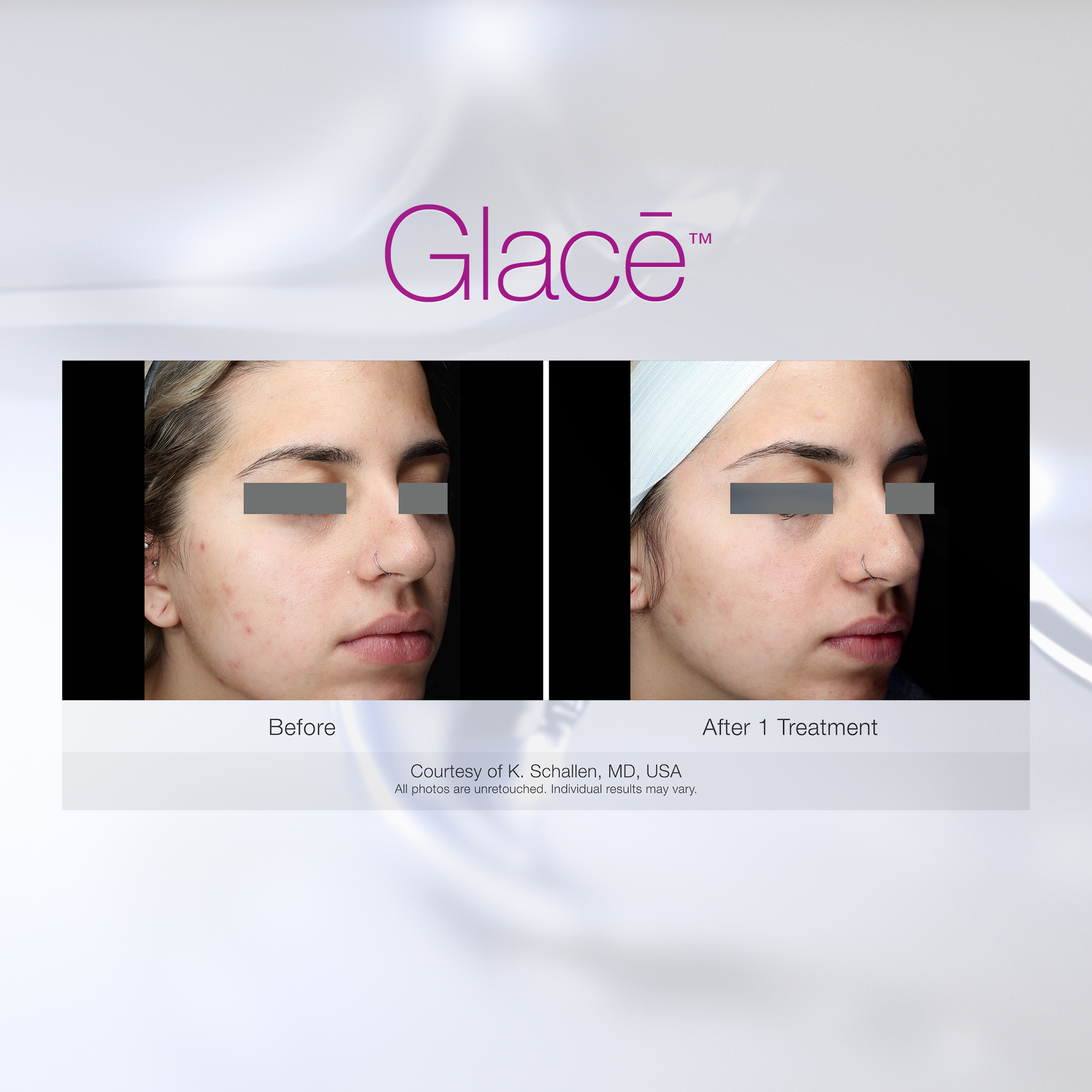 Package of 3 Glacē Facials