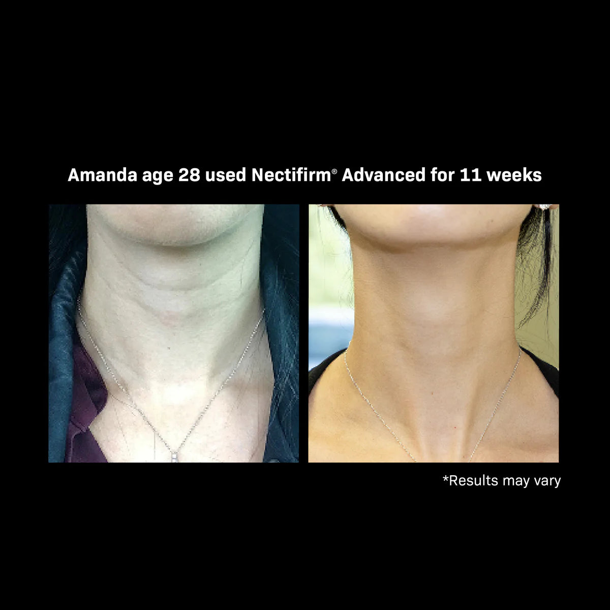 Nectifirm Advanced TRAVEL SIZE